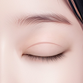 double eyelid revision surgery in korea rine plastic surgery