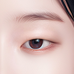 double eyelid revision surgery in korea rine plastic surgery
