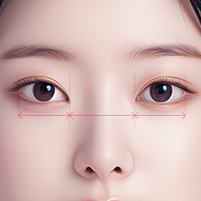 Non-Incisional Double Eyelid Surgery in Korea, RINE Plastic Surgery
