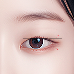 Non-Incisional Double Eyelid Surgery in Korea, RINE Plastic Surgery
