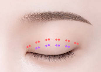 Non-Incisional Double Eyelid Surgery in Korea, RINE Plastic Surgery