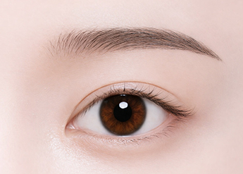Ptosis Correction in Korea, RINE Plastic Surgery