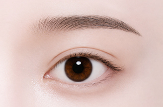 Non-Incisional Double Eyelid Surgery in Korea, RINE Plastic Surgery