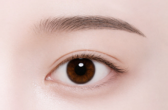 Non-Incisional Double Eyelid Surgery in Korea, RINE Plastic Surgery