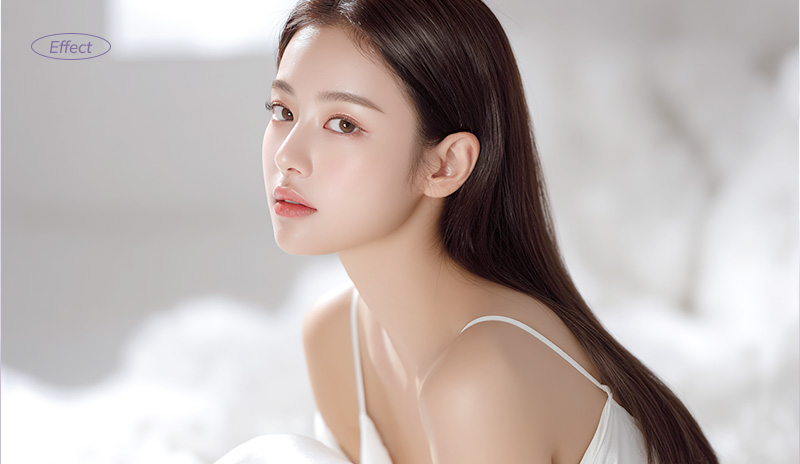 Epicanthoplasty Revision in Korea, RINE Plastic Surgery