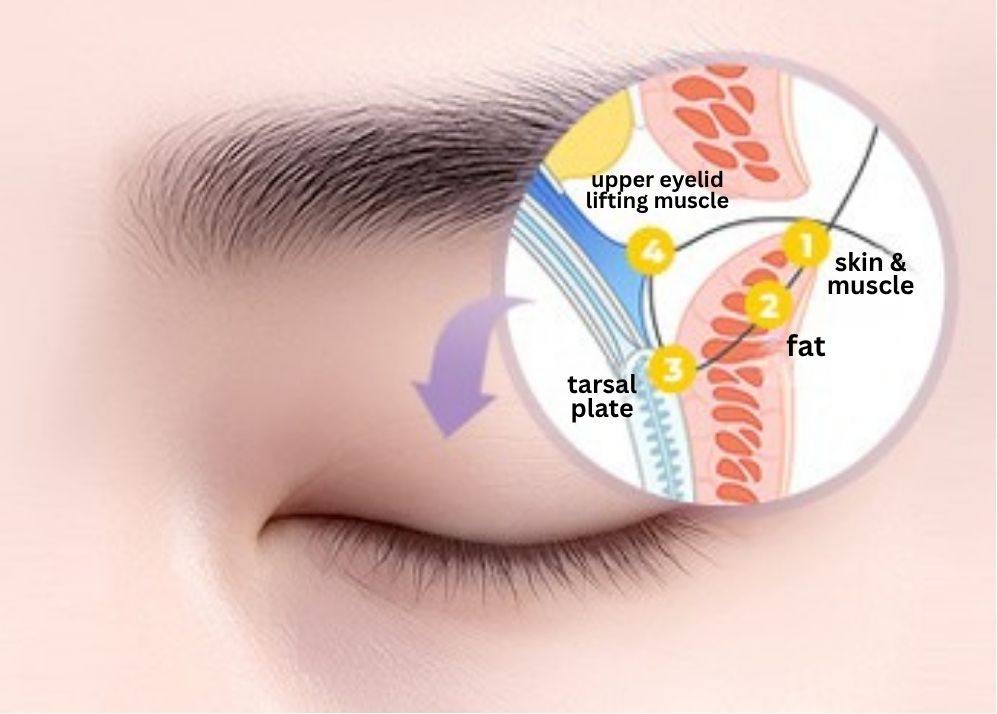 Eyelid Surgery for Men, RINE Plastic Surgery